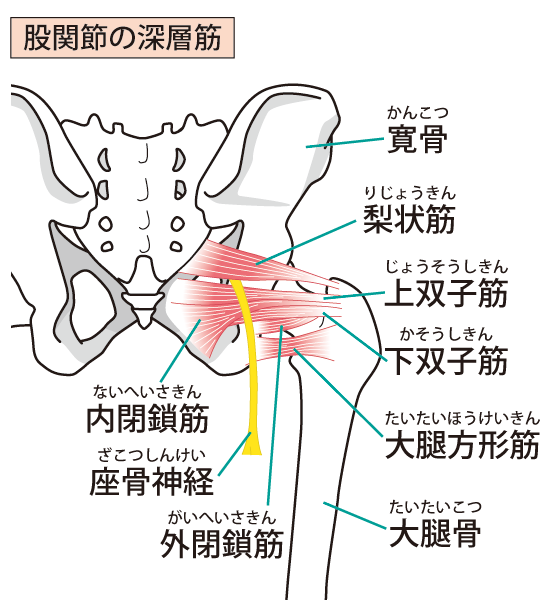 坐骨神経痛とは?