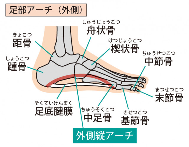 足底筋膜炎
