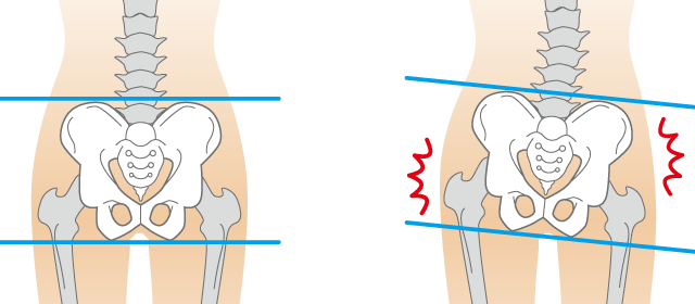 生理痛に対するアプローチは？