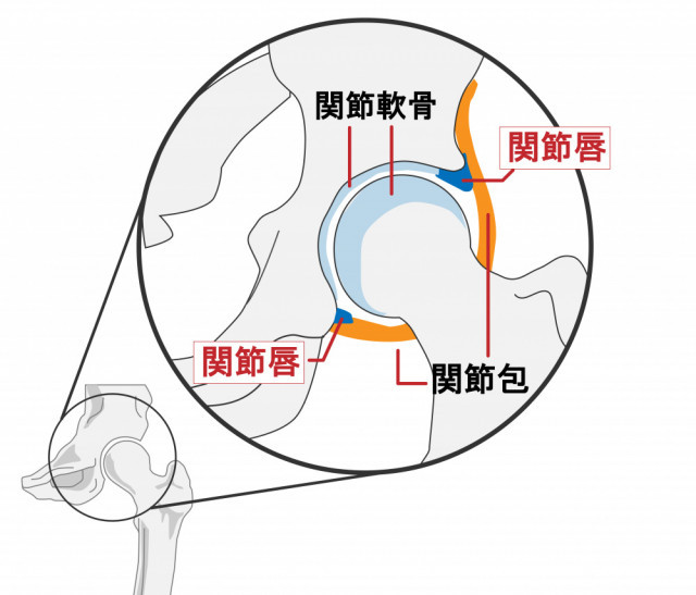 股関節痛とは?